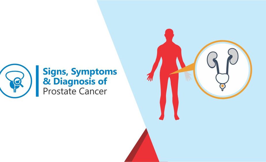 Signs, Symptoms, and Diagnosis of Prostate Cancer