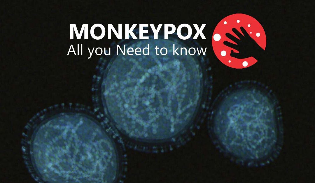 Monkey Pox: All You Need To Know