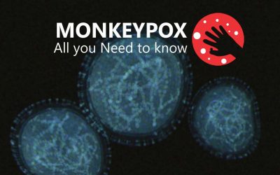 Monkey Pox: All You Need To Know