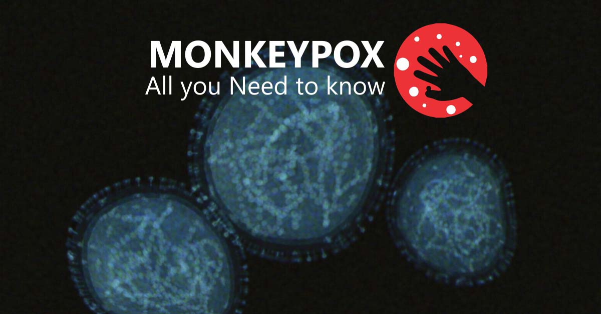 Monkey Pox: All you need to know